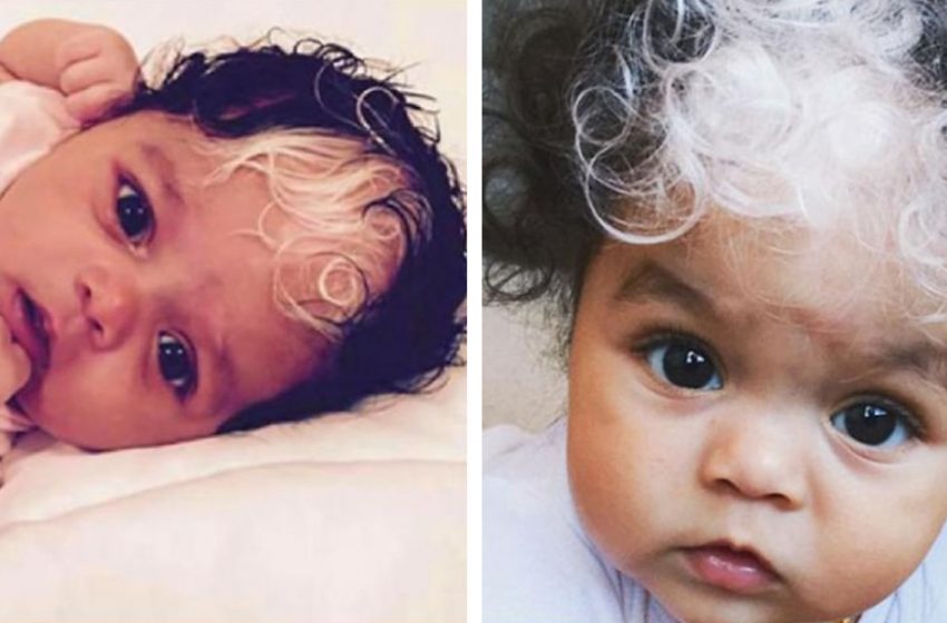  This baby was born with a snow-white strand of hair. She surprised everyone except her mother…