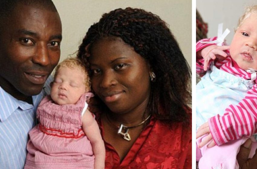  Ten years ago a Snow White was born to a Nigerian family, how does the girl look now?