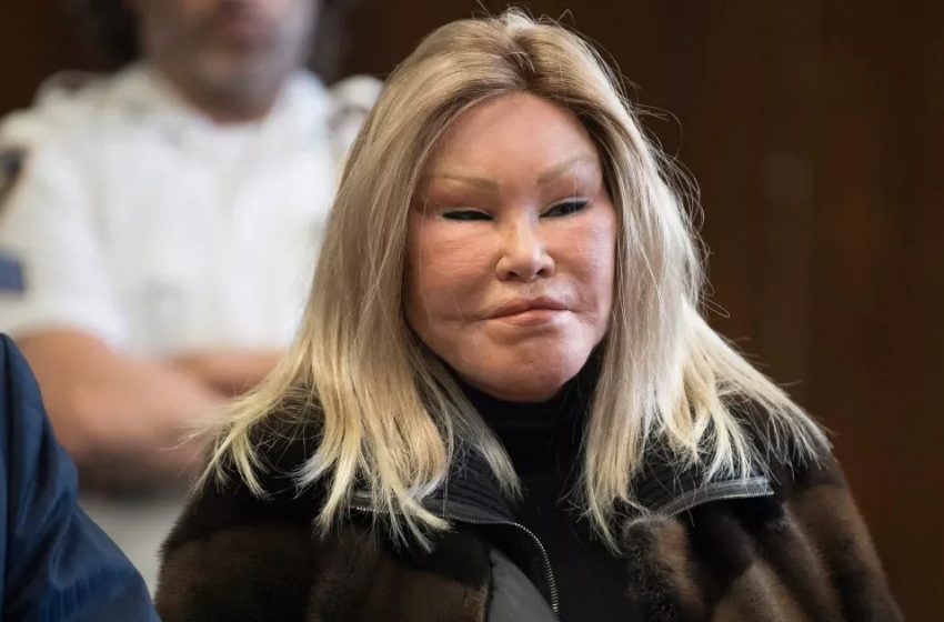  Cat Woman: How a woman with an unusual appearance looked before plastic surgery