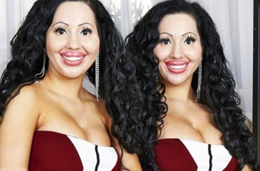  Australian sisters spent $250,000 for an identical makeover. How did they look before!