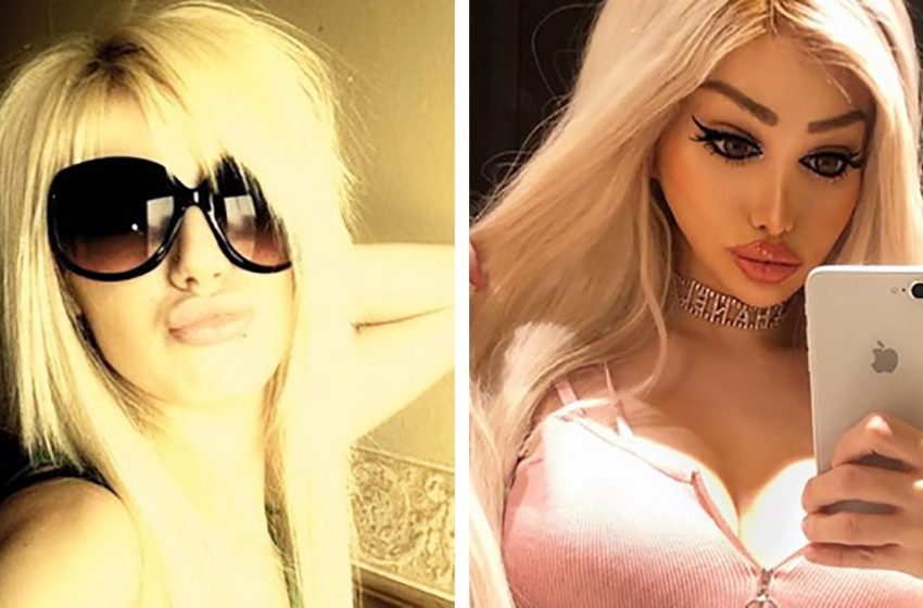  Silicone Barbie: How a girl spent hundreds of thousands of dollars to look like a legendary doll