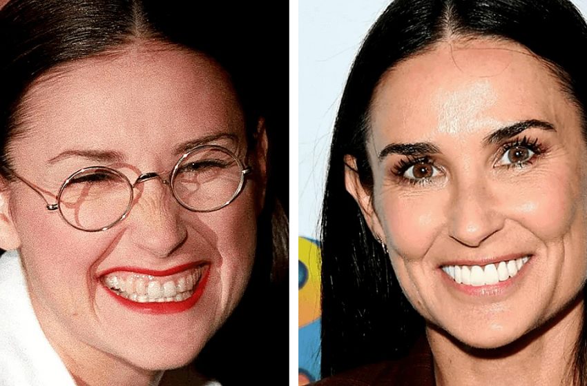  How much teeth have changed the image of celebrities: 9 star transformations