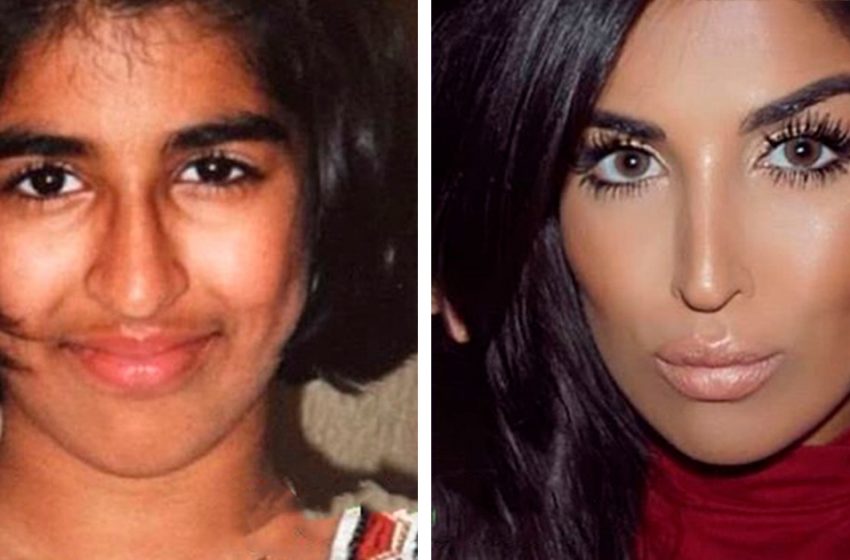  Before and after plastic surgery: 10 cases showing that you can become a real beauty when you have a lot of money