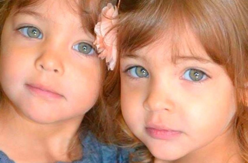  What have become the world’s most beautiful twins, who are famous from birth