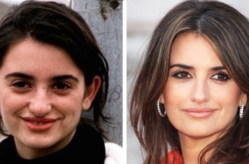  ‘Age Or Rhinoplasty’: 10 Celebrities who have become much more attractive after their nose changes