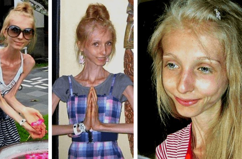  How 9 years later Ksenia looks and lives, who dreamed of a beautiful life as a model