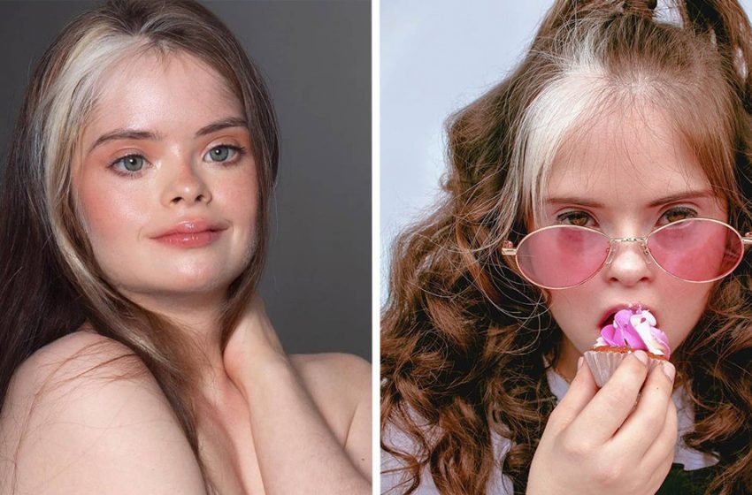  The stunning model with Down syndrome is an icredible example to be a self-confident and grateful individual