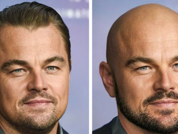  What would celebrities look like without their hair