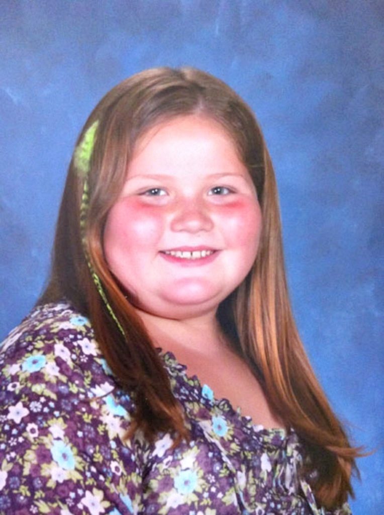 She was bullied because of her weight when she was nine. But look at ...