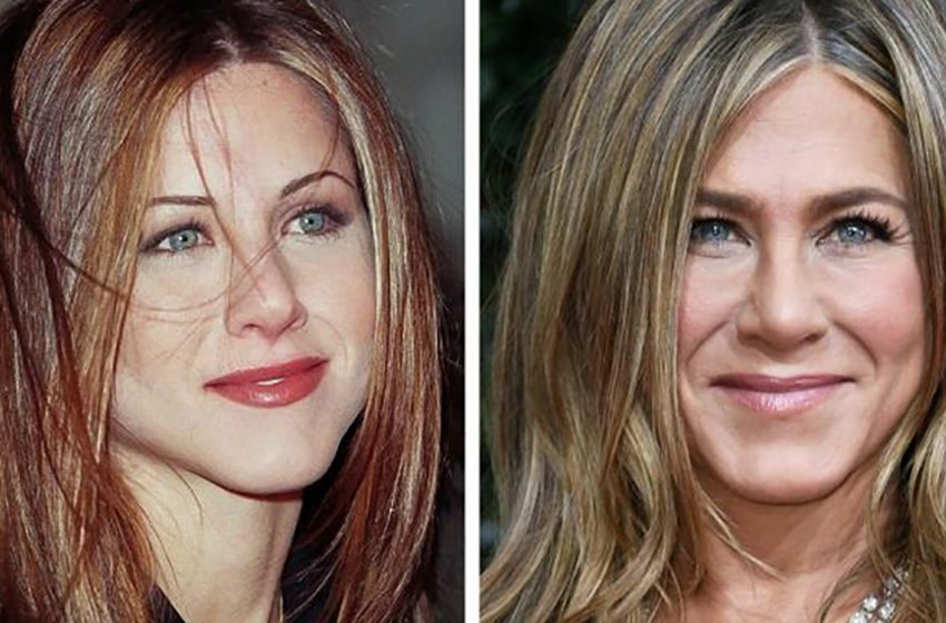  How the celebrities, who were highly appreciated for their natural beauty, have changed now