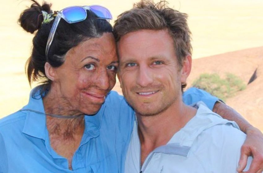  The touching story of this couple will make everyone believe in real love