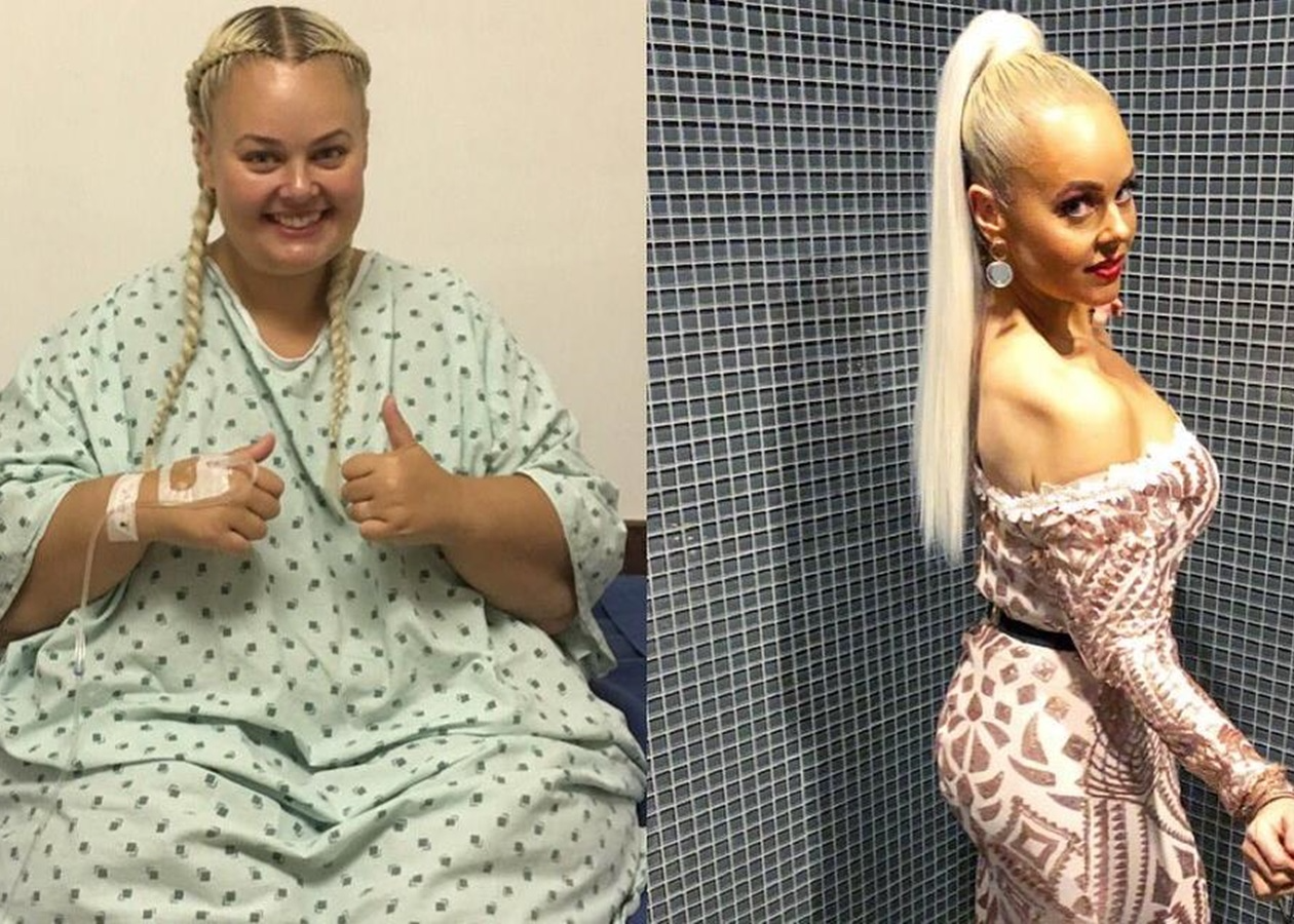 what-an-amazing-change-the-girl-lost-80-kg-to-look-like-her-idol