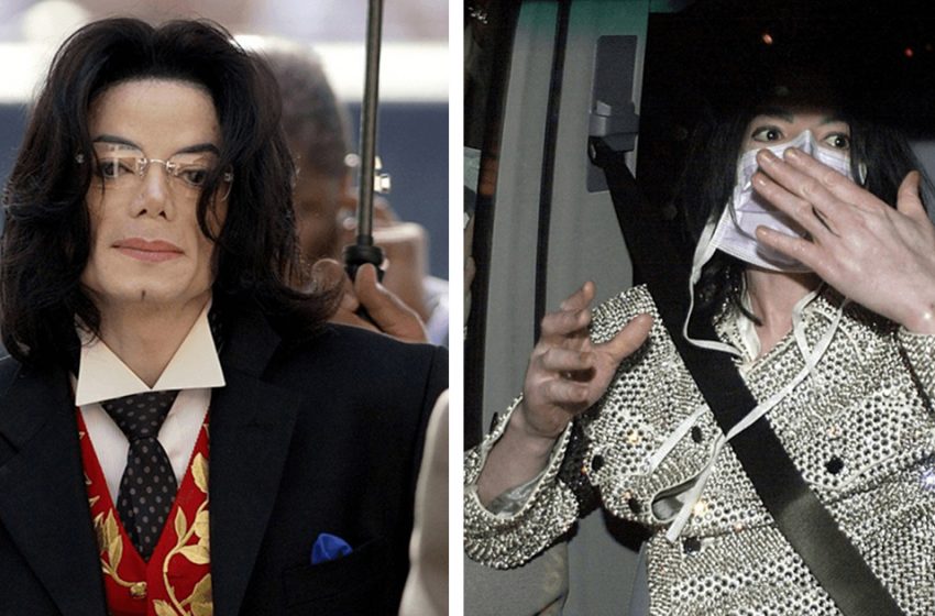  Testimoni oculari ricordano come appariva Michael Jackson senza naso finto