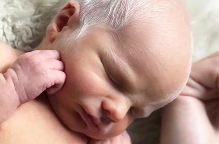  Il bambino veniva deriso per avere i capelli bianchi : Com’è ora il suo aspetto