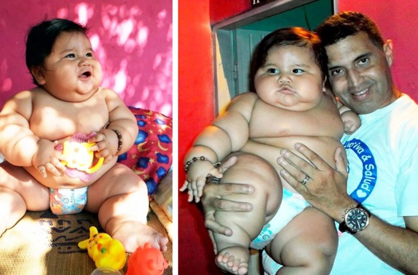  Un bambino di 8 mesi dalla Colombia pesava quanto 20 chilogrammi: Com’è ora l’aspetto del ragazzo?