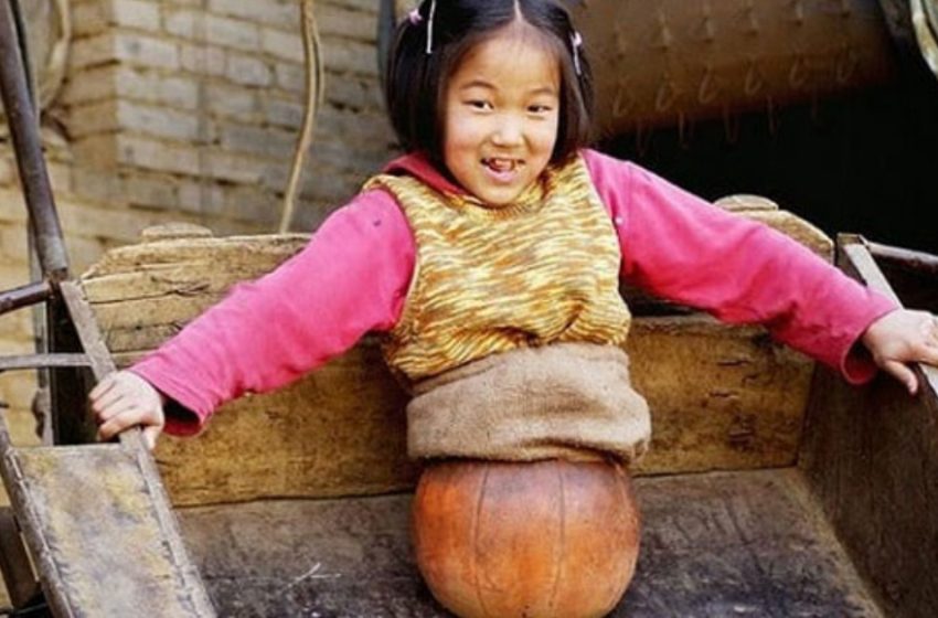  La ragazza ha perso le gambe dopo un incidente: una palla da basket ha sostituito le sue gambe e grazie alla sua perseveranza è diventata una campionessa!