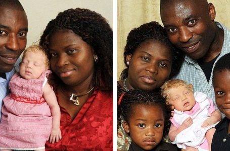 “La nascita di una bambina ‘Biancaneve’ in una famiglia nigeriana dieci anni fa ha sconvolto tutti”: com’è oggi?