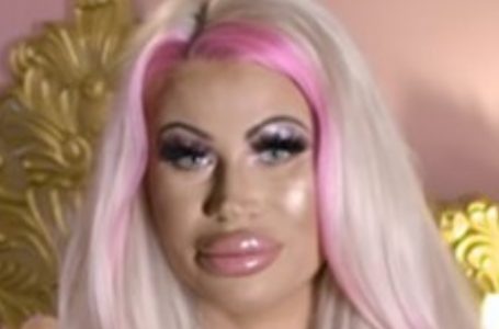 Mamma criticata per aver speso 170.000 dollari in chirurgia plastica!  Scopri com’era prima!