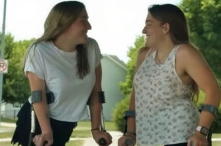Ex gemelle siamesi, oggi adolescenti felici che vivono una vita normale!: A dieci anni dall’intervento che ha cambiato tutto!