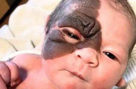 Nata con un segno unico, la straordinaria trasformazione di questa coraggiosa ragazza ti scioglierà il cuore: ecco le sue foto!