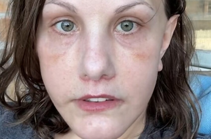 “Irriconoscibile dopo un lifting da 15 mila dollari”: la trasformazione di questa ragazza manda il web in tilt!