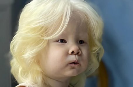 Conosci le sorelle albine nate a 12 anni di distanza? Stanno conquistando il mondo della moda – Guarda le loro foto!