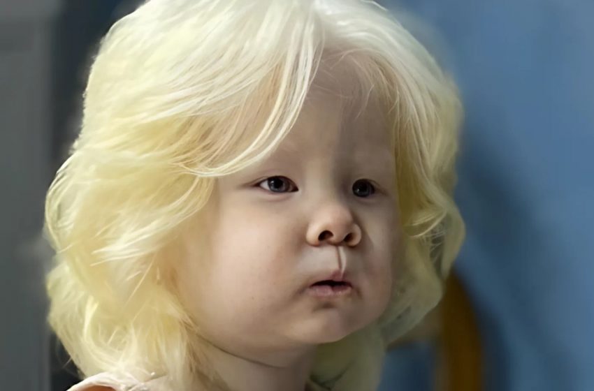 Conosci le sorelle albine nate a 12 anni di distanza? Stanno conquistando il mondo della moda – Guarda le loro foto!