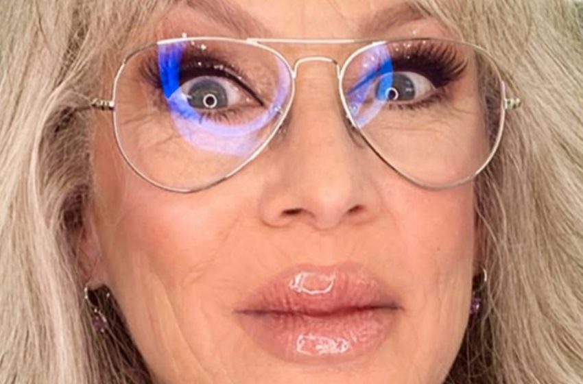  Leggenda di Hollywood sorprende i fan con labbra esagerate e un look audace!