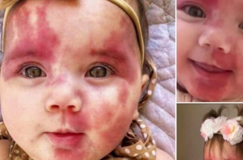  Bambina Chiamata “Oribile” e “Difettosa” Stupisce Tutti con la Sua Incredibile Trasformazione! Guarda le Foto!