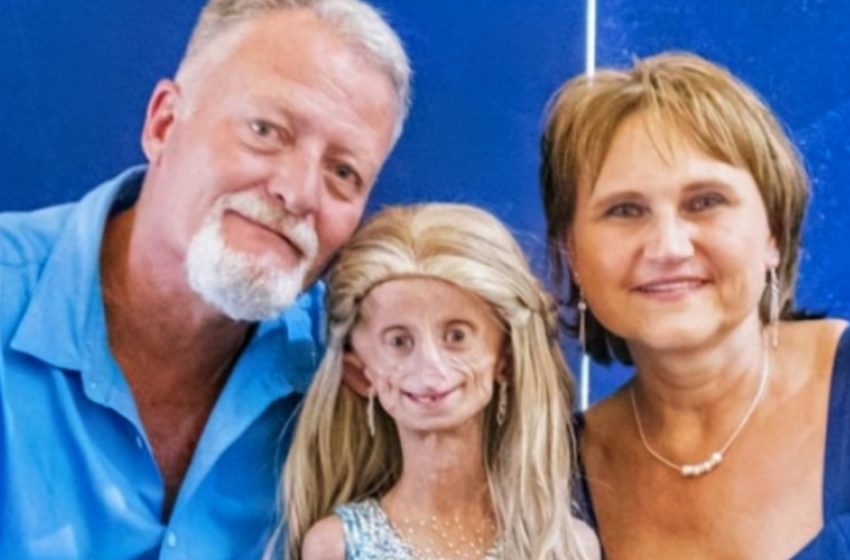  Una giovane che invecchiava otto volte più velocemente condivide un messaggio commovente che sta ispirando il mondo: scopri i dettagli