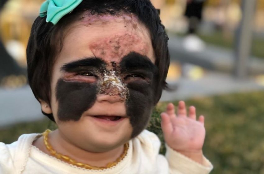  Un tempo derisa per il suo viso da “Batman”, oggi incanta tutti con il suo aspetto da principessa: “Una ragazza straordinaria!”