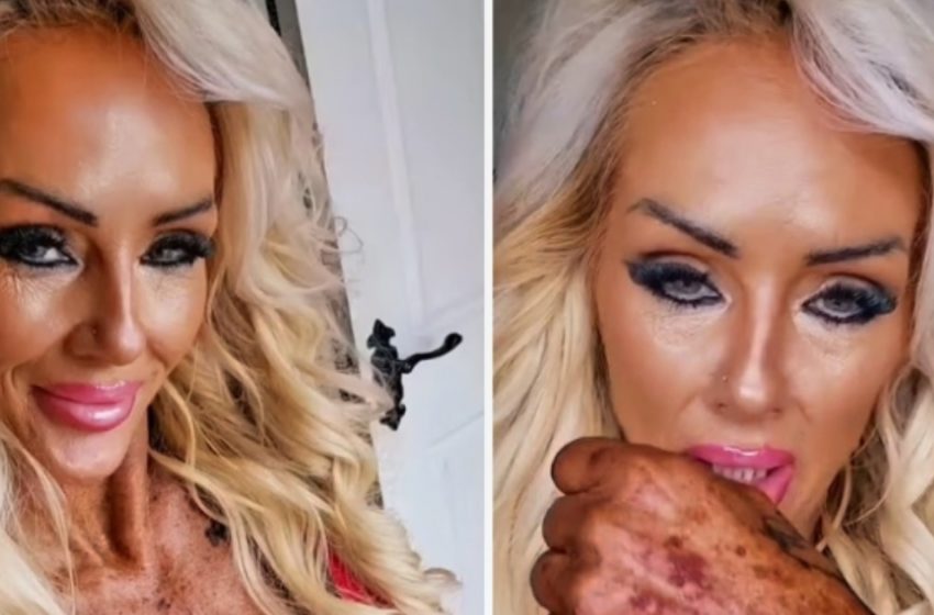  Una Vita di Abbronzature… Ma a Quale Prezzo? La sua pelle è riuscita a guarire, o i danni sono irreversibili?